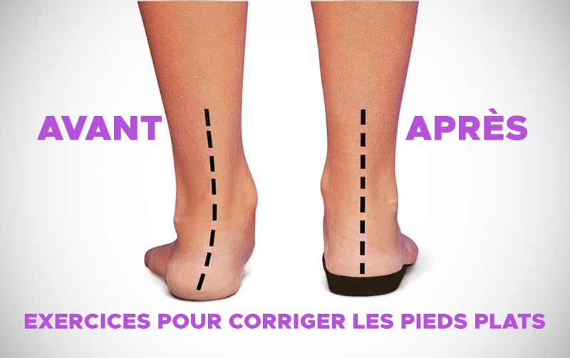 Pieds Plats Exercices Pour Corriger L Arche Du Pied Remedes De Grand Mere